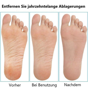 Schälfeile aus Edelstahl